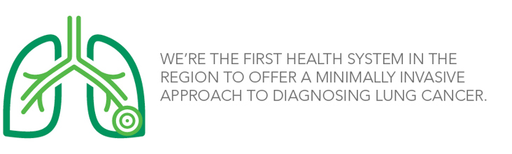 We're the first health system in the region to offer a minimally invasive approach to diagnosing lunch cancer.