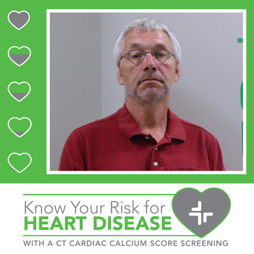 Russ - CT Cardiac Calcium scoring patient